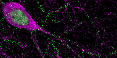 Hemmende Neuronen (pink) sind wichtig, um die Aktivität neuronaler Netzwerke im Gehirn zu justieren.
