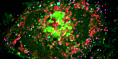 Kontaktstelle zwischen Lipidtröpfchen (türkis) und Mitochondrium (rot)