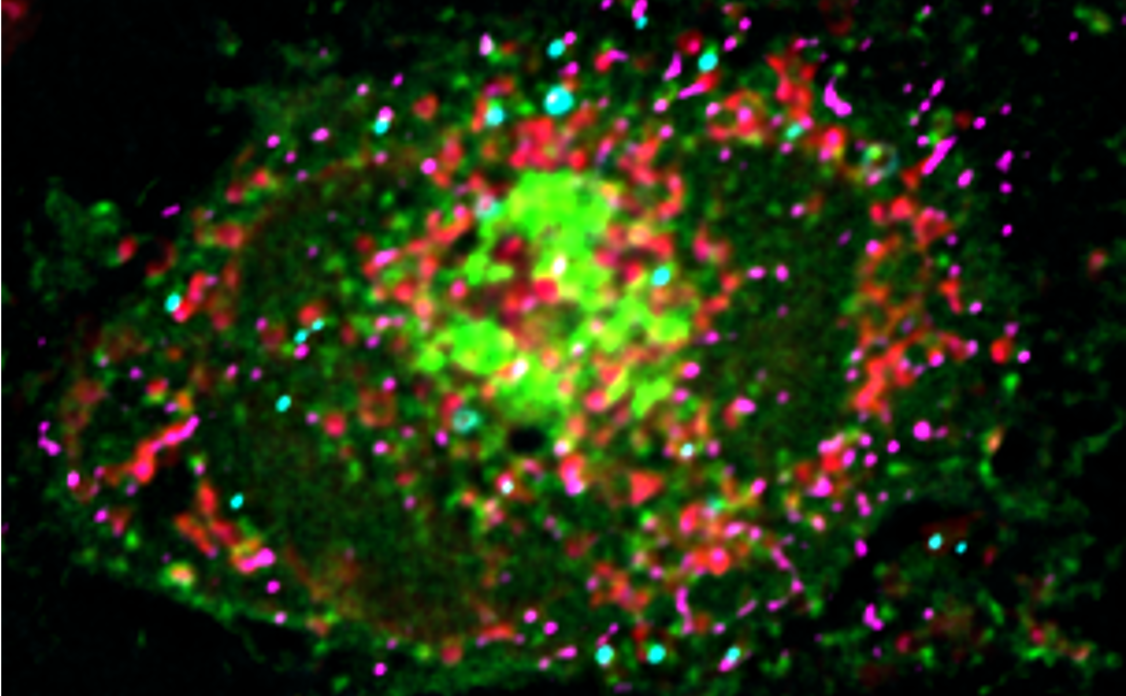 contact site between lipid droplets (turquoise) and mitochondria (red)