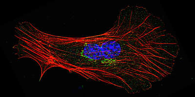 Mouse fibroblast stained for coronin 2 (green) and actin filaments (red).