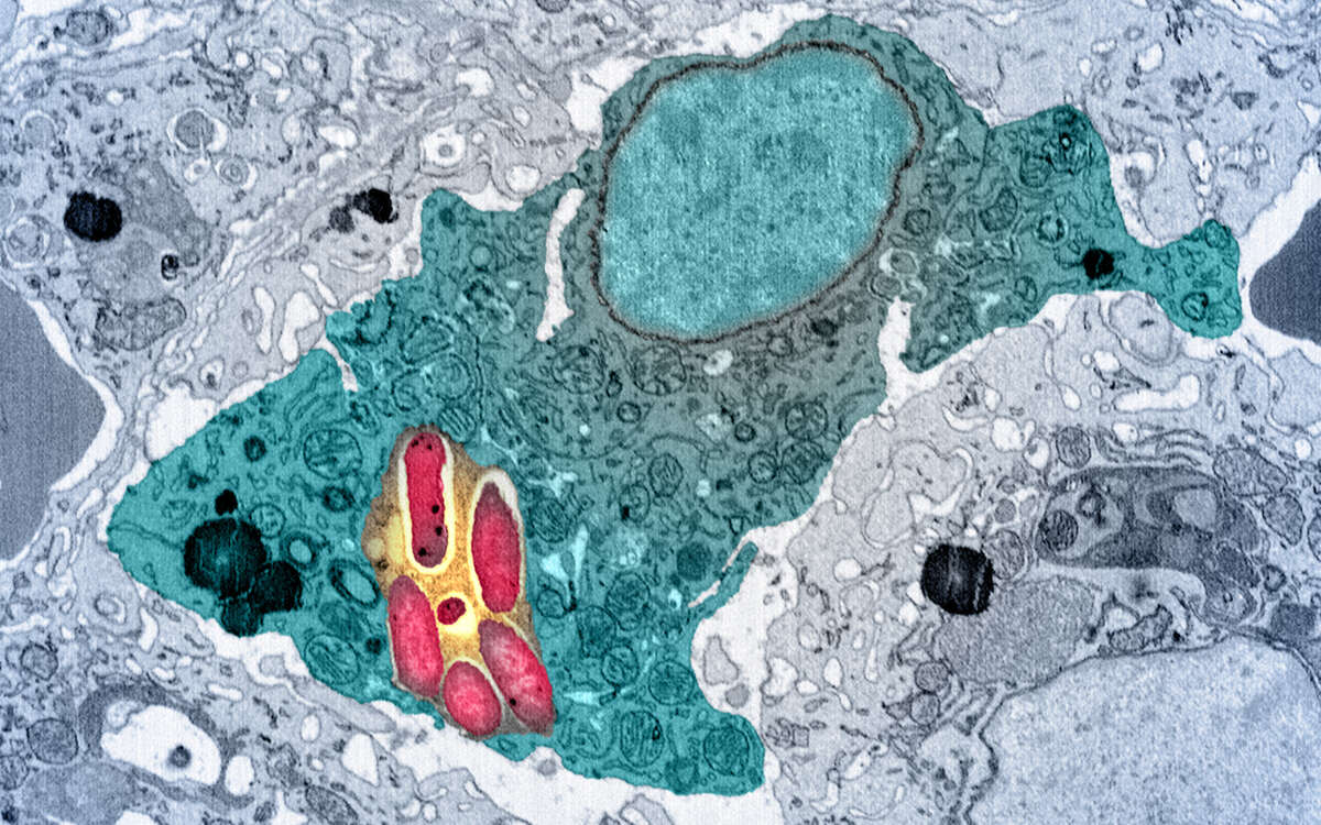 Salmonellen (rot) im Verdauungsvesikel (gelb) einer Fresszelle in der Milz.